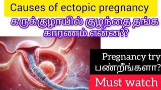 Causes of ectopic pregnancy in tamiltubal pregnancy risk factorsectopicpregnancy [upl. by Neely417]