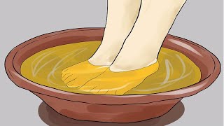 5 Remedios Caseros Para Hongos En Los Pies O Pie De Atleta [upl. by Sherburne]