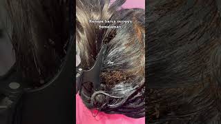 Picking a thousand of lice on hair How to get rid of lice hair wigs skincare 2 3 [upl. by Darton]