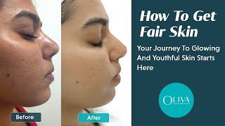 Fair Skin Secrets Revealed  Myths Facts And Treatment Options [upl. by Alicec]