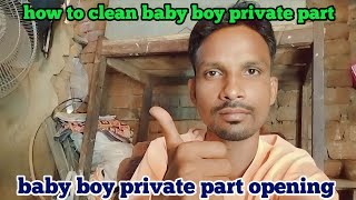 how to clean baby boy private part  baby boy private part opening [upl. by Arod]