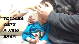 TODDLER EAR WAX REMOVAL [upl. by Iv]