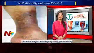 Laser Treatment For Varicose Veins  Varicose Veins  Causes amp Treatment  Hello Doctor  NTV [upl. by Lytle]