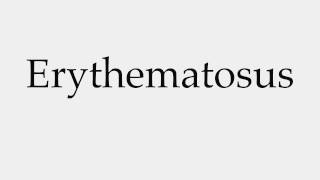 How to Pronounce Erythematosus [upl. by Moncear]