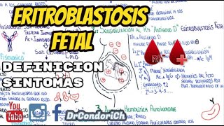 Eritroblastosis Fetal Incompatibilidad Rh ¿Que es¿como sospechar [upl. by Arikal]