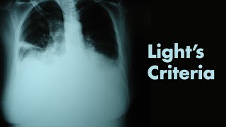 How to recognize different pleural effusions on chest CT [upl. by Haneekas]