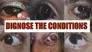 PATHOLOGICAL EYE CONDITIONS 1 Ophthalmology Osce [upl. by Tidwell402]