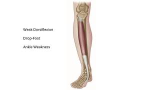 Tibialis Anterior  Trigger Point Release  Self Help [upl. by Paymar]