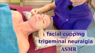 Trigeminal Neuralgia Follow Up Treatment 💝 Unintentional ASMR Real Person [upl. by Buttaro]