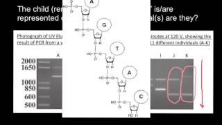 How to understand Gel Electrophoresis results 5 [upl. by Mowbray]