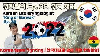 귀지형의 Ep38 귀지제거 Korean otolaryngologist “King of earwax” Ep 38 earwax removal [upl. by Esra]