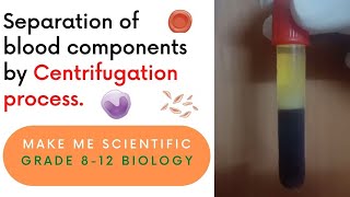 Separation of Human Blood Components by Centrifugation Process  Grade 812  Biology Demo [upl. by Searcy988]