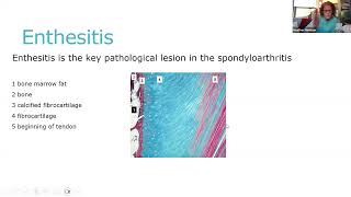 Rheumatology Physiotherapy UK axial Spondyloarthritis part 1  May 2024 [upl. by Nelg]