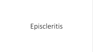 Episcleritis  Ophthalmology [upl. by Assenab246]