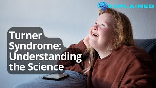 Turner Syndrome Understanding the Science [upl. by Rhyner]