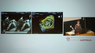 Quantification of mitral regurgitation  Dr Lisa Simmons [upl. by Ahsinam757]