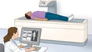 DEXA SCAN [upl. by Neural]