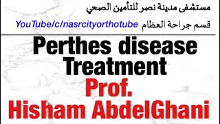 Perthes disease Treatment Prof Hisham AbdelGhani nasrcity online 2020 [upl. by Aerehs]