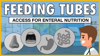 Types of Feeding Tubes EXPLAINED [upl. by Airdnua884]