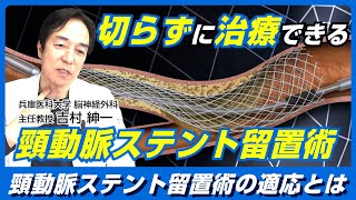 切らずに治療できる！頚動脈ステント留置術CASとは？脳神経外科医 吉村紳一Drが徹底解説！ [upl. by Estele]