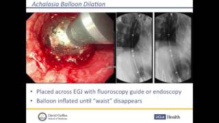 Achalasia – Treatment Options  Jeffrey L Conklin MD  UCLA Digestive Disease [upl. by Ybloc]