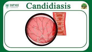 Candidiasis What is Candidiasis Candida Species– Morphology Pathogenesis of Candida Albicans [upl. by Lamrouex]