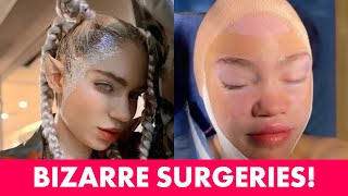 10 Most Bizarre Plastic Surgeries You Wont Believe Are Real [upl. by Nylsor722]