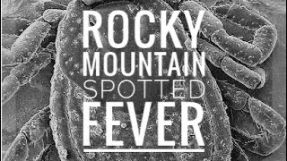 Rocky Mountain Spotted Fever Rickettsia rickettsii [upl. by Limak]