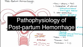 Pathophysiology of Postpartum Hemorrhage [upl. by Teerpnam392]