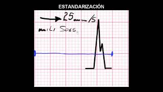 CURSO DE ELECTROCARDIOGRAFIA 10  ESTANDARIZACIÓN VELCIDAD DEL PAPEL Y AMPLITUD [upl. by Nylodnarb59]