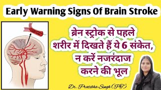 Early warning signs of Brain Stroke Paralysis  ब्रेन स्ट्रोक होने से पहले के 6 जरूरी संकेत [upl. by Yeffej]