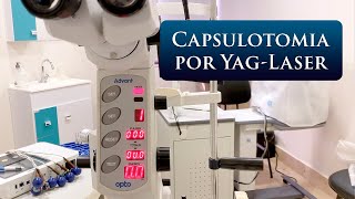 CAPSULOTOMIA POR YAGLASER [upl. by Culbertson446]