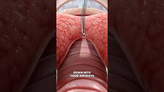 Bronchoscopy 3D Animation [upl. by Tnomel]