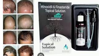 Folltholo F Topical Solution Minoxidil amp Finasteride Topical Solution [upl. by Button130]