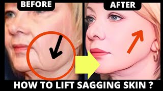 🛑 CHISELED JAWLINE EXERCISE  LIFT SAGGING SKIN SAGGY CHEEKS JOWLS LAUGH LINES FOREHEAD [upl. by Oilla]