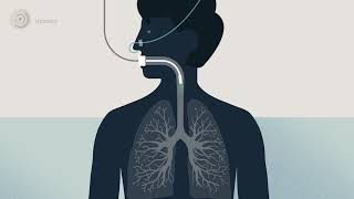 Bronchoscopy  examination of your airways English version [upl. by Stuckey]