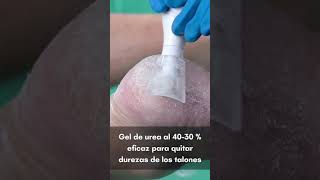 ¿Tu Pie Necesita Un quotResetquot Prueba el Gel de Urea para Durezas [upl. by Jacy905]