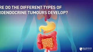 Symptoms Types and Diagnosis of Neuroendocrine Tumours NETs [upl. by Cicenia688]