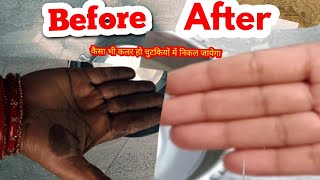 How to Remove Hair Dye from skin घंटो का काम मिंटो अब डाइ हाथो से निकले चुटकियों मे ये ट्रिक देखलो [upl. by Margo335]