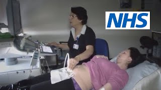 What happens at a scan and what will they tell me  NHS [upl. by Hebe262]