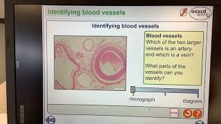 KS5ALEVELBIOLOGYTransport in animalsIdentifying Micrograph blood vessels [upl. by Aztilay]