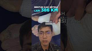 Kondisi kaki setelah lari 386 km selama 63 jam [upl. by Grigson877]