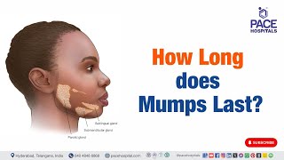 Mumps Last  How Long does Mumps Last  mumps shorts viralvideo [upl. by Audy746]