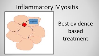 Myositis Inflammatory Myopathy Treatment [upl. by Analise]