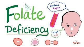 Folate deficiency  Megaloblastic Anemia  Macrocytic  Hematology Series [upl. by Schumer]