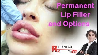 Permanent Lip Filler and OptionsDr Rajani [upl. by Tamaru]