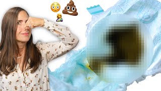 Meconium Your Baby’s First Poop IMAGES [upl. by Akirdna]