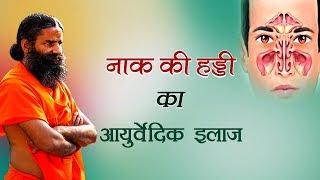 नाक की हड्डी का आयुर्वेदिक इलाज  Swami Ramdev [upl. by Arahk419]