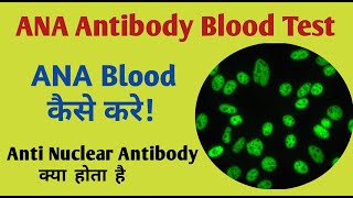 ana antibody I antinuclear antibody [upl. by Jessica]