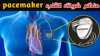 ماهو منظم ضربات القلب؟ وكيف يعمل What is a pacemaker and how does it work [upl. by Holton]